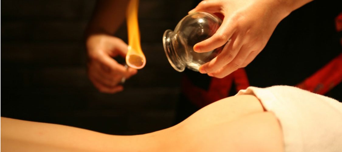 Moxabustão + Ventosoterapia (艾灸 + 拔罐)